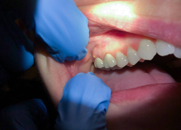 Best Urgent Dental Care for Toothache in Rio Vista, TX